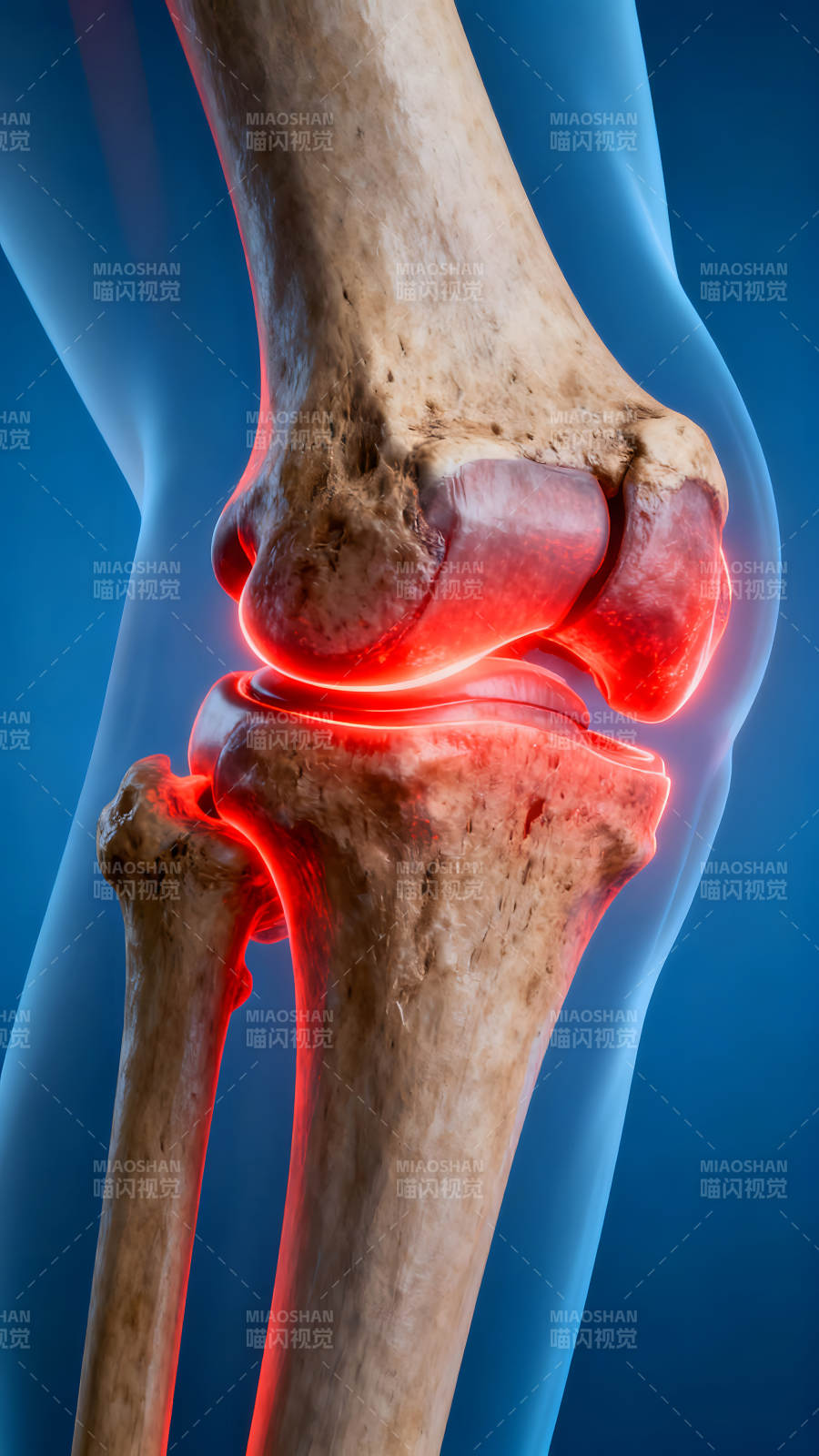膝盖关节的解剖展示炎症发炎图片