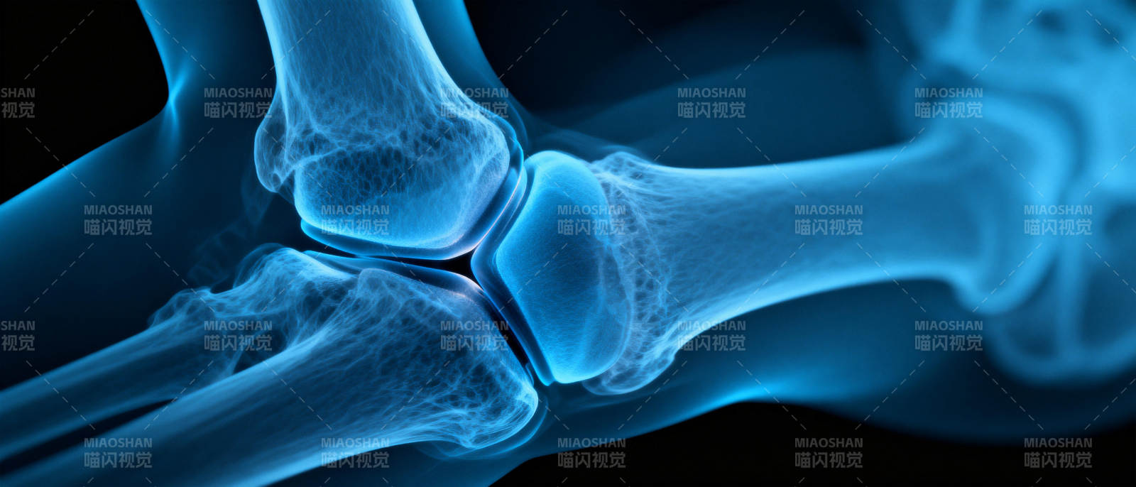 膝关节X光图图片