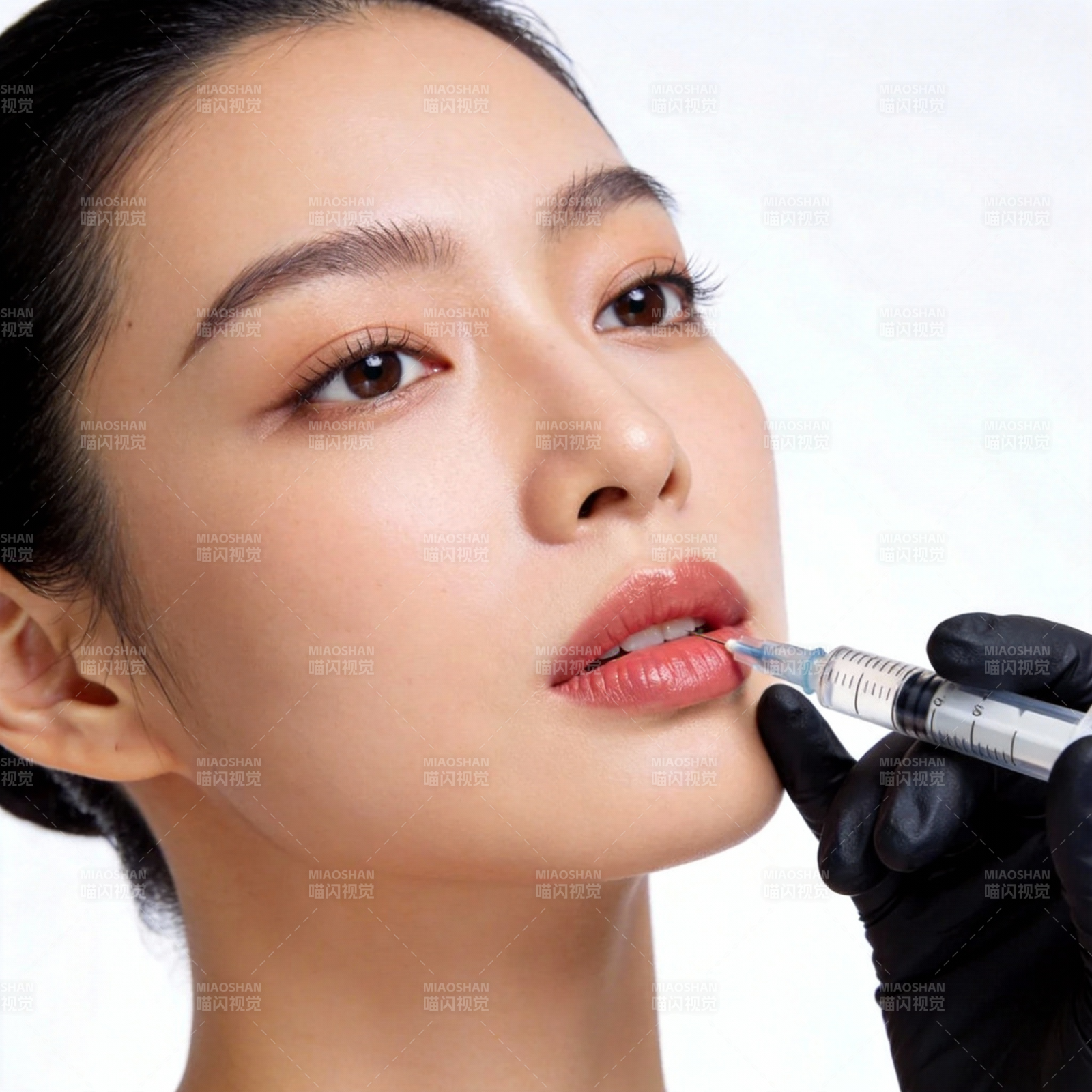 唇部微整形图片