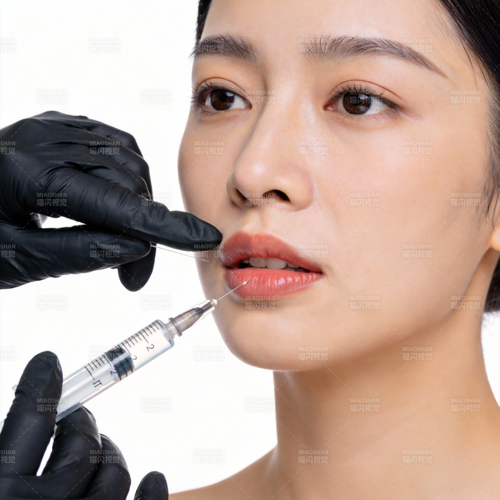 唇部微整形图片