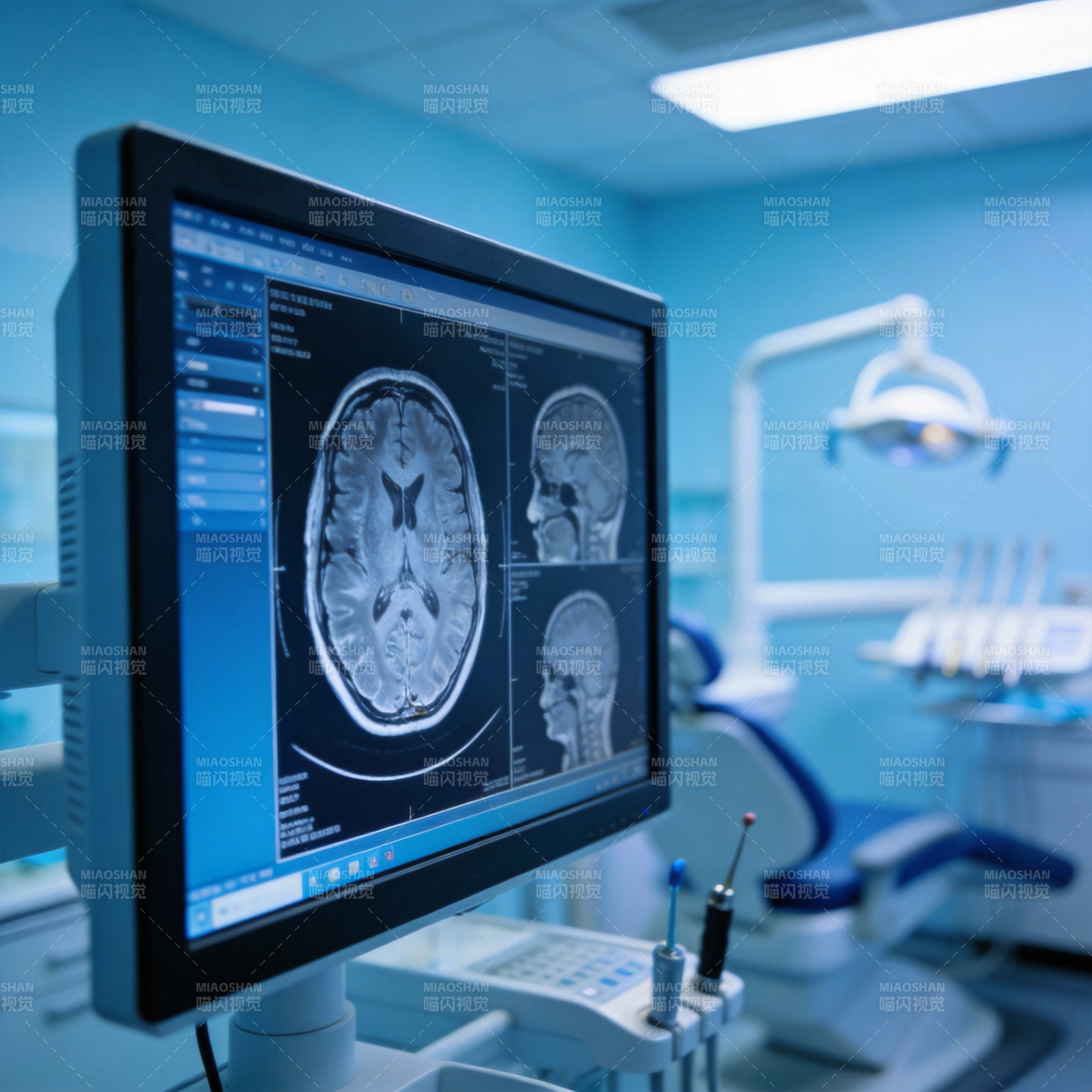 脑部CT扫描影像图片