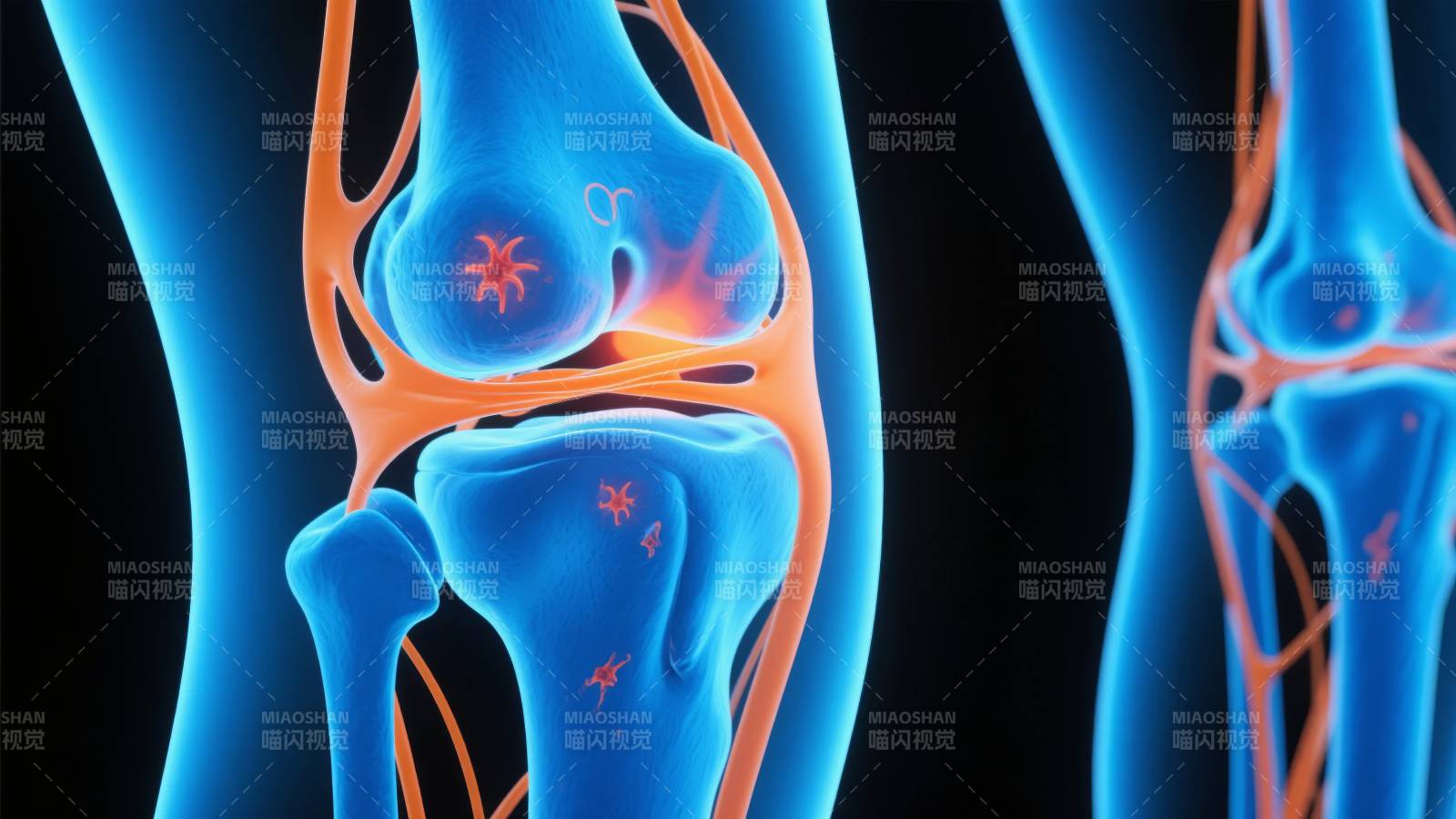 膝关节疼痛示意图图片