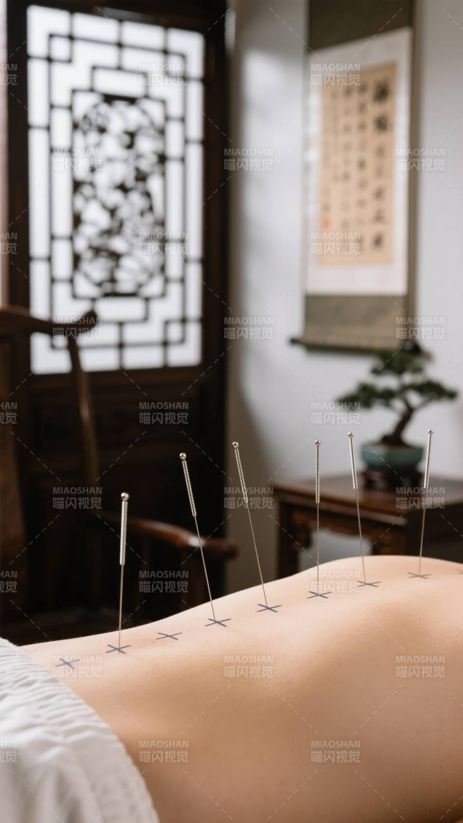 针灸治疗场景图片