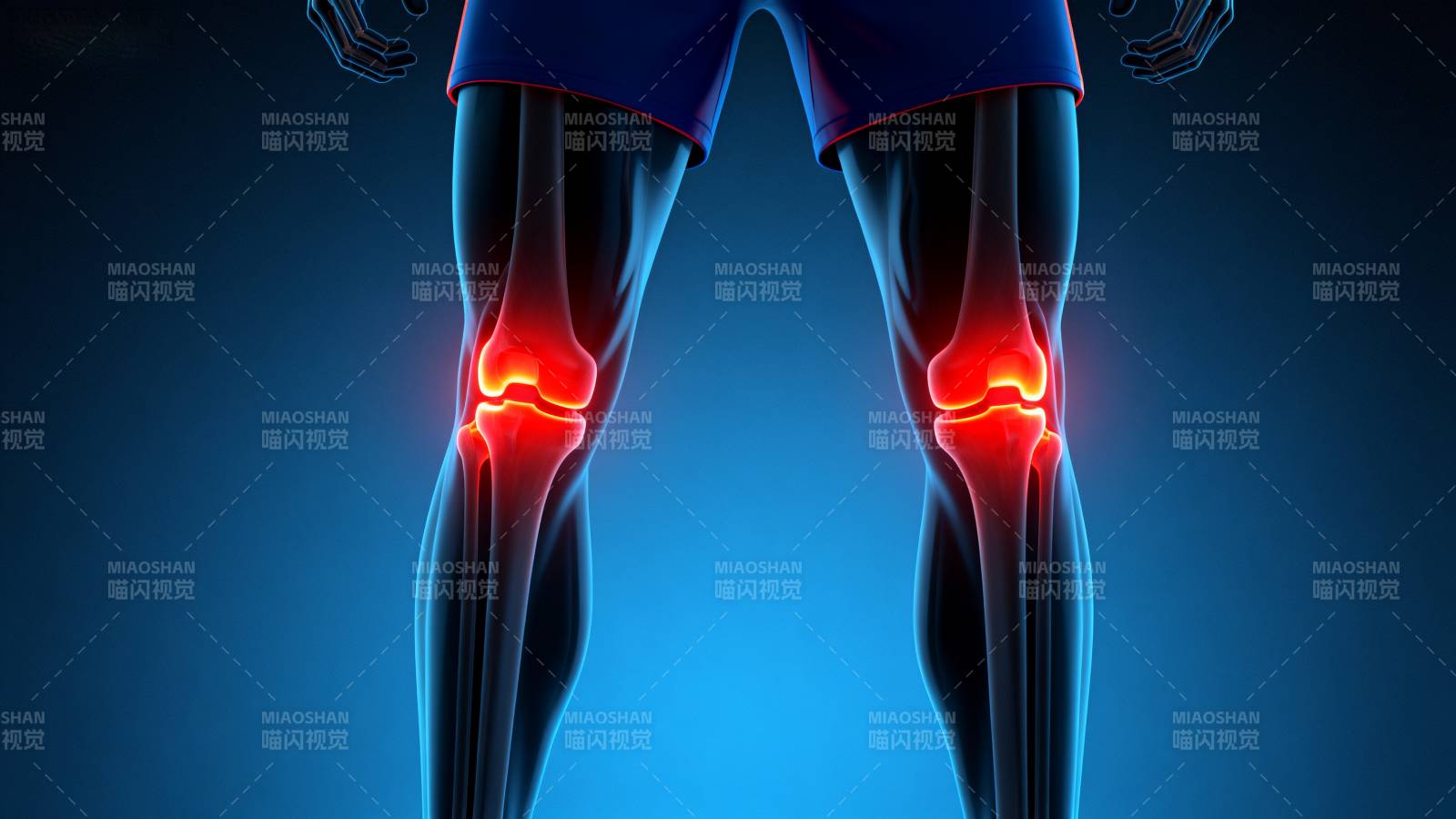 膝盖疼痛示意图图片