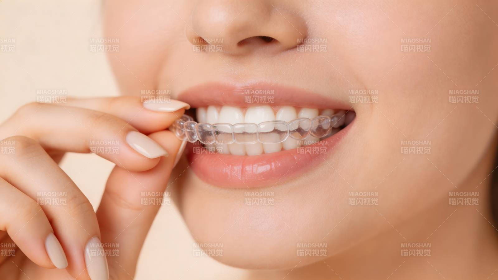 隐形牙套微笑美齿图片