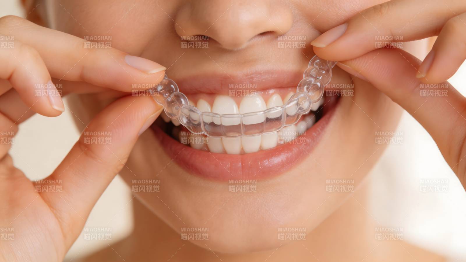隐形牙套微笑美齿图片
