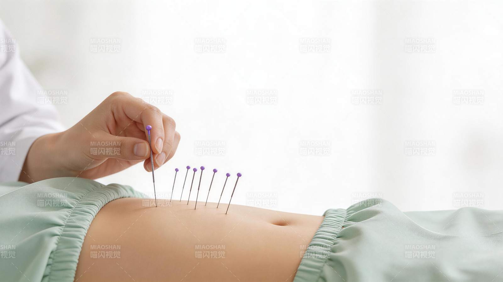 医生为患者腹部进行针灸治疗操作图片