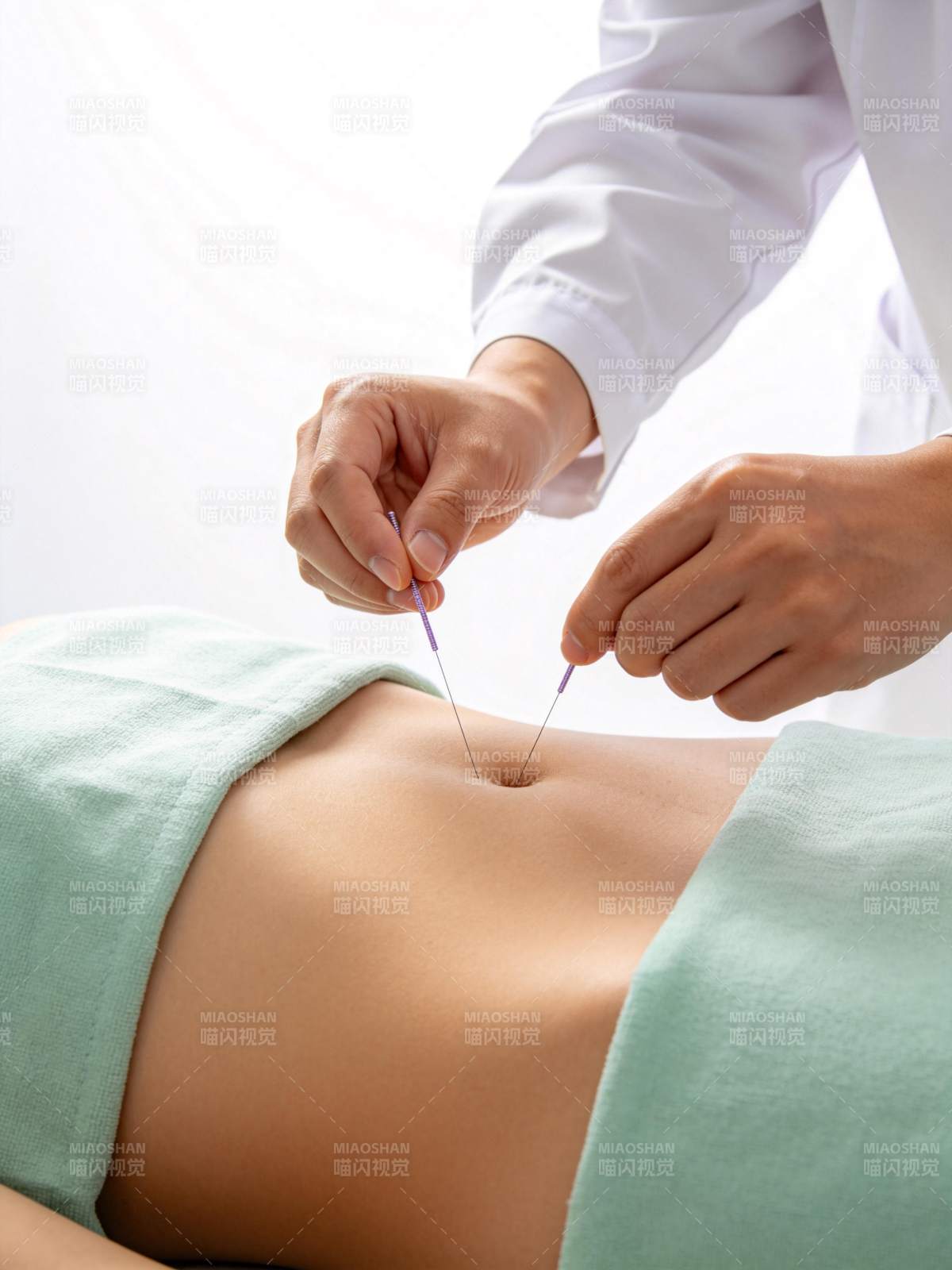 医生为患者腹部进行针灸治疗操作图片