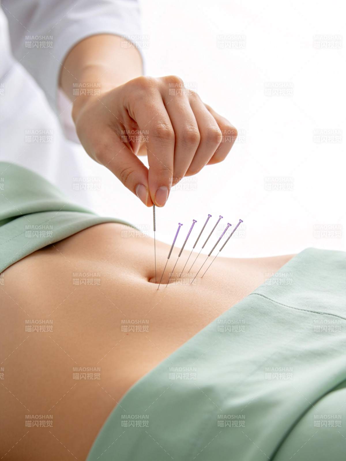 医生正在为患者腹部进行针灸治疗操作图片