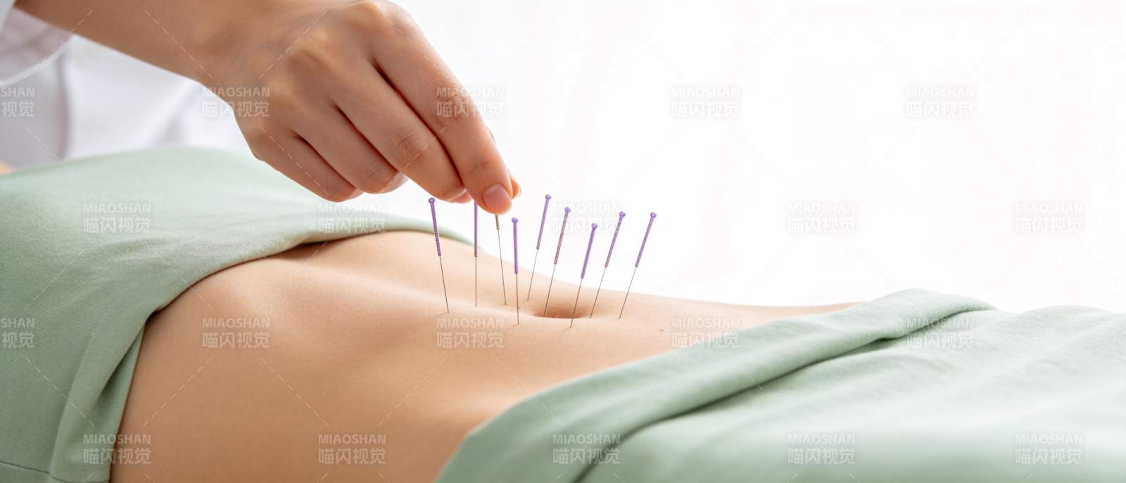 针灸师正在为患者腹部施针治疗图片