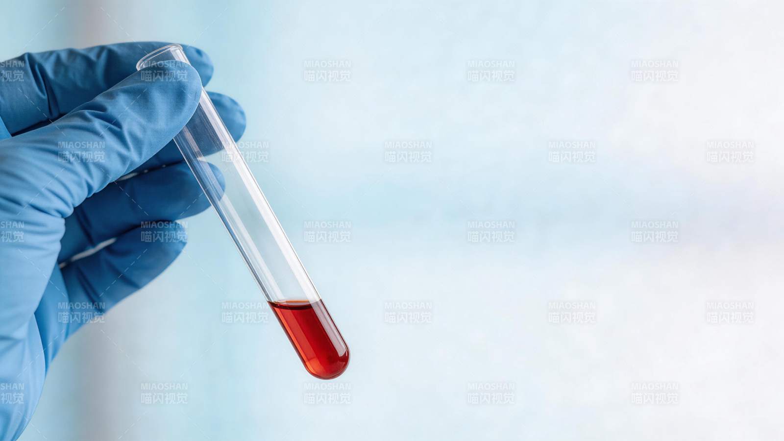 戴蓝色手套手持装有红色液体的试管图片