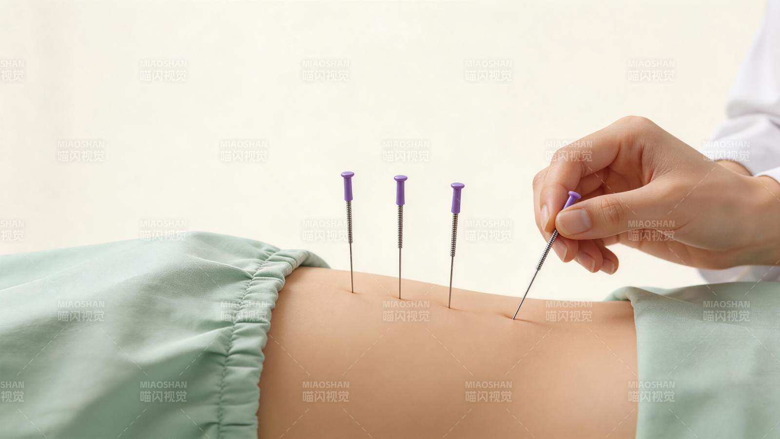 医生正在为患者进行针灸治疗操作图片