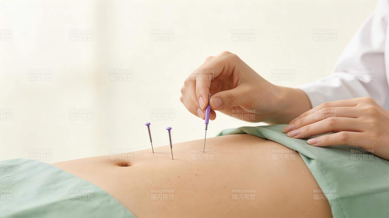 医生正在为患者腹部进行针灸治疗操作图片