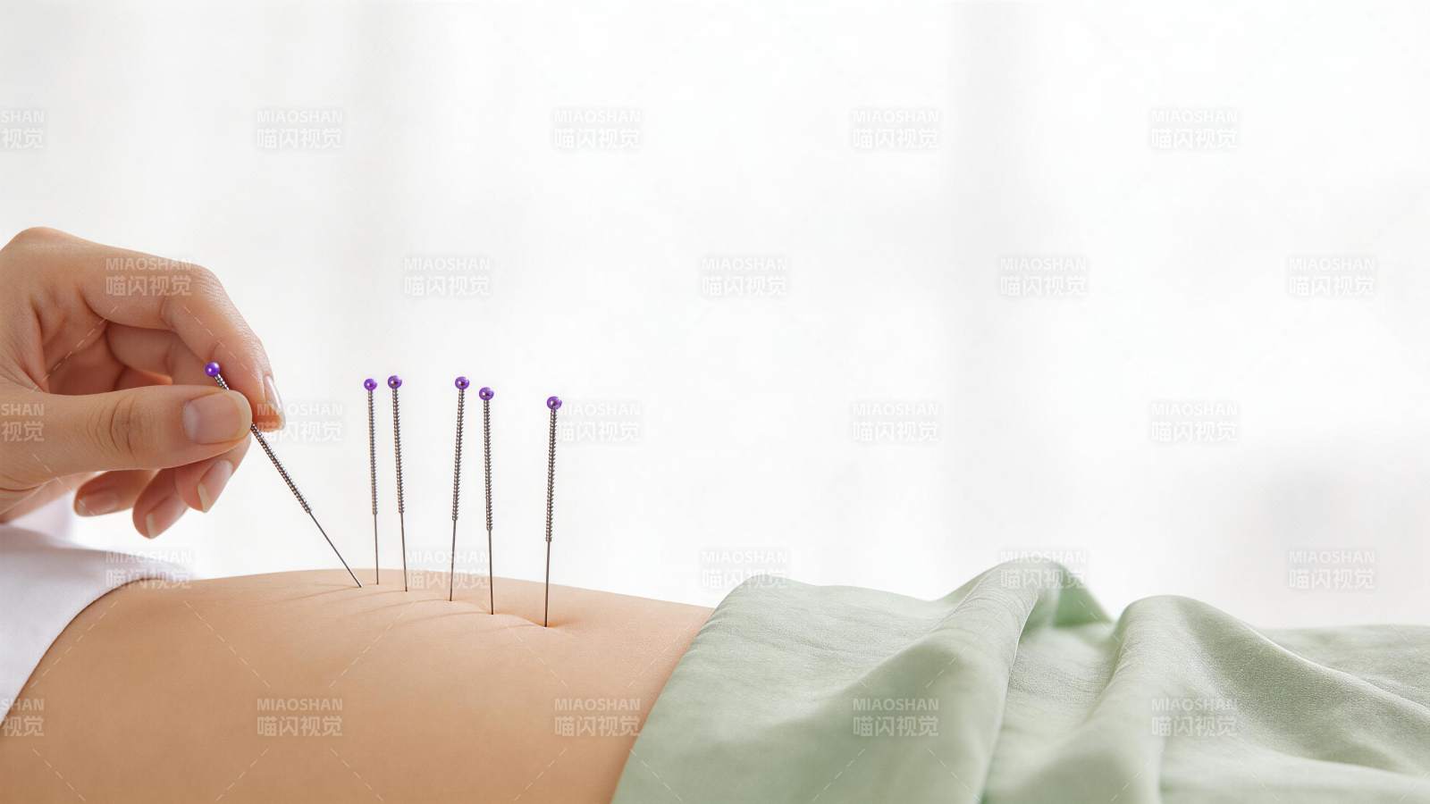 手部操作银针进行腹部针灸治疗图片