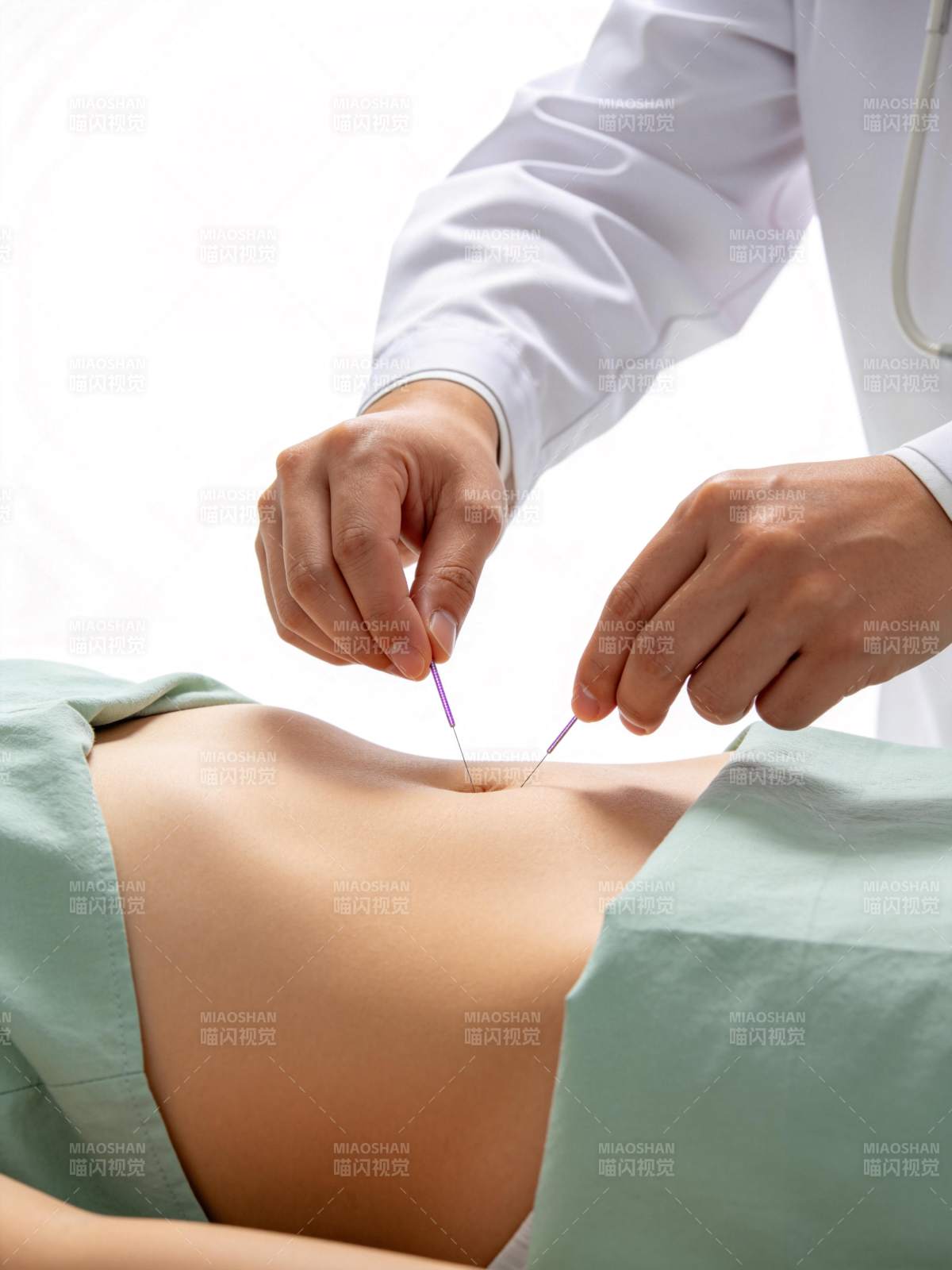 医生为患者腹部进行针灸治疗操作图片