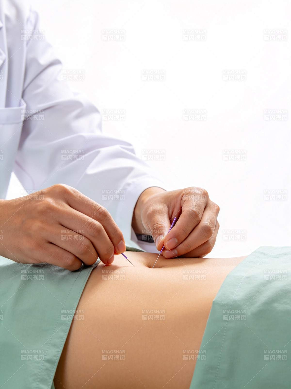 医生为患者腹部进行针灸治疗操作图片