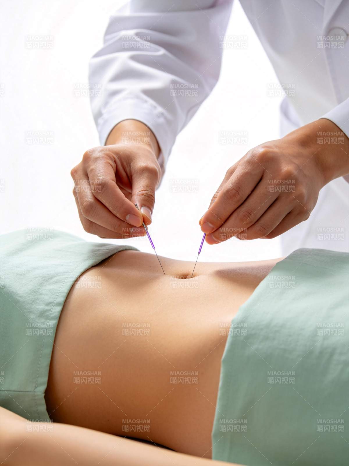 医生为患者腹部进行针灸治疗操作图片