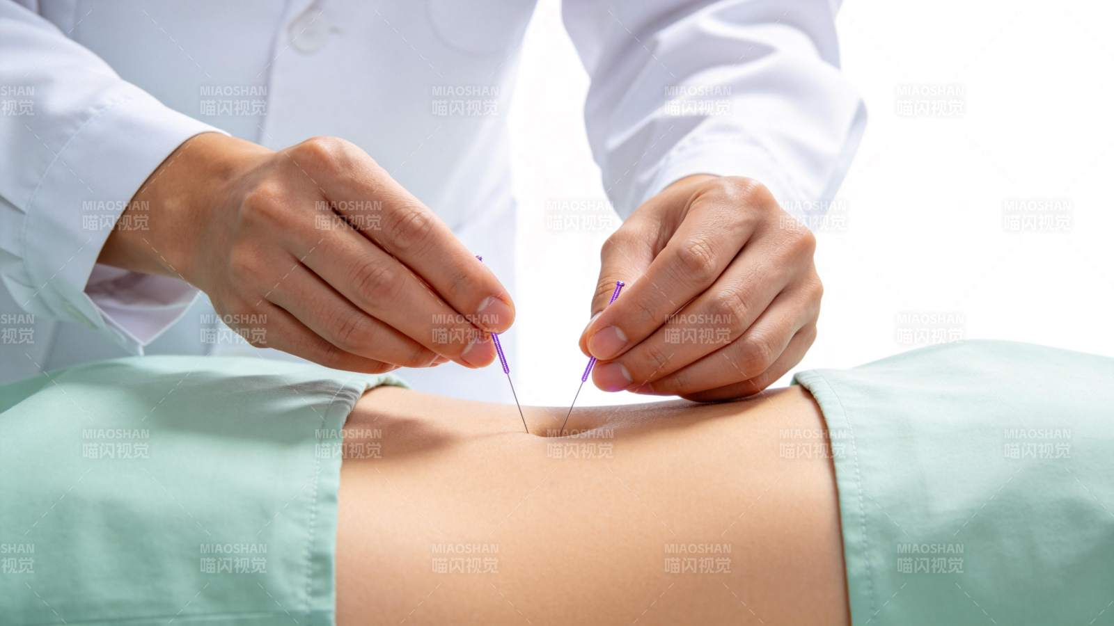 医生双手持针进行腹部针灸治疗操作图片