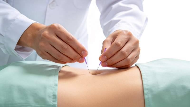 医生双手持针进行腹部针灸治疗操作图片