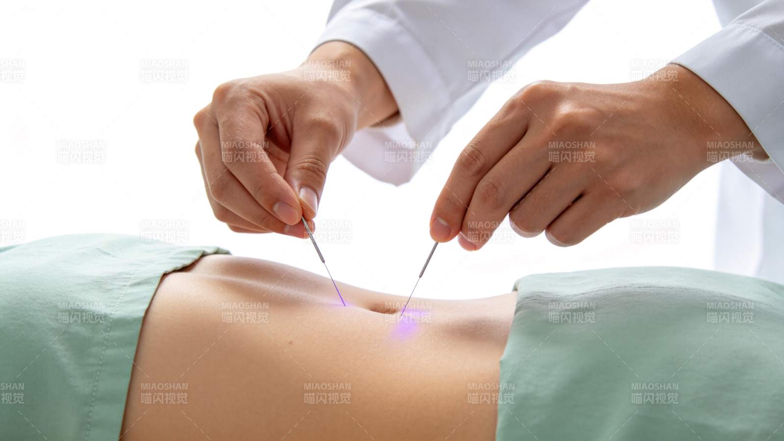 医生双手持针进行腹部针灸治疗操作图片