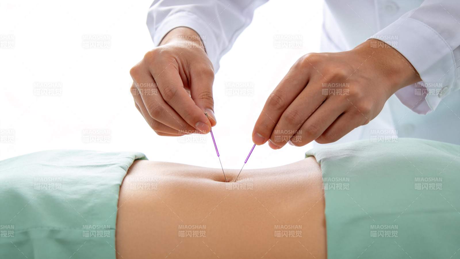 医生双手持针进行腹部针灸治疗操作图片