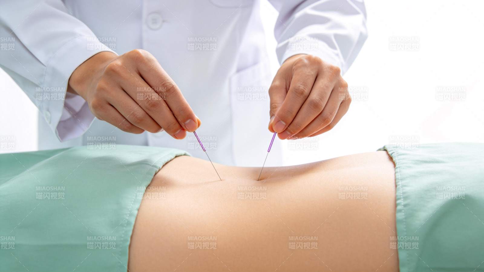 医生双手持针进行腹部针灸治疗操作图片