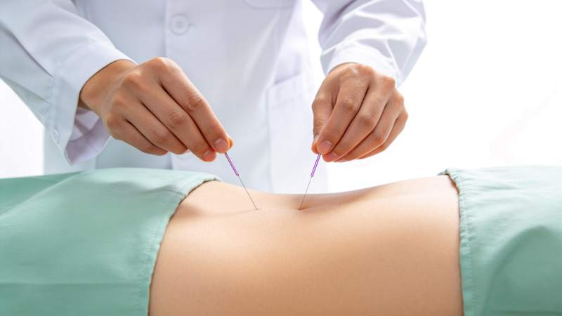 医生双手持针进行腹部针灸治疗操作图片