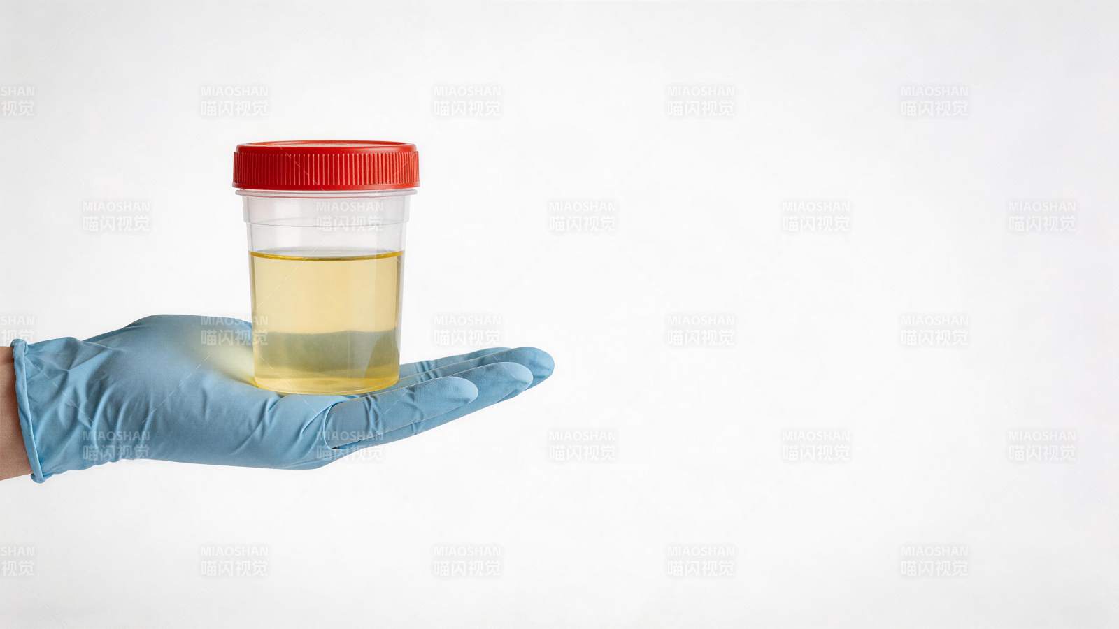 戴蓝色手套的手托着装有黄色液体的采样杯图片