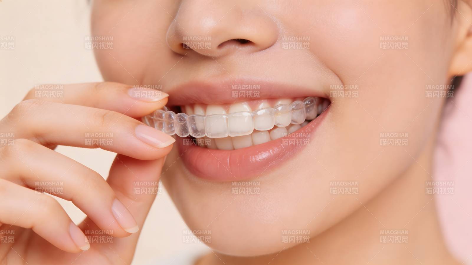 隐形牙套微笑美齿图片