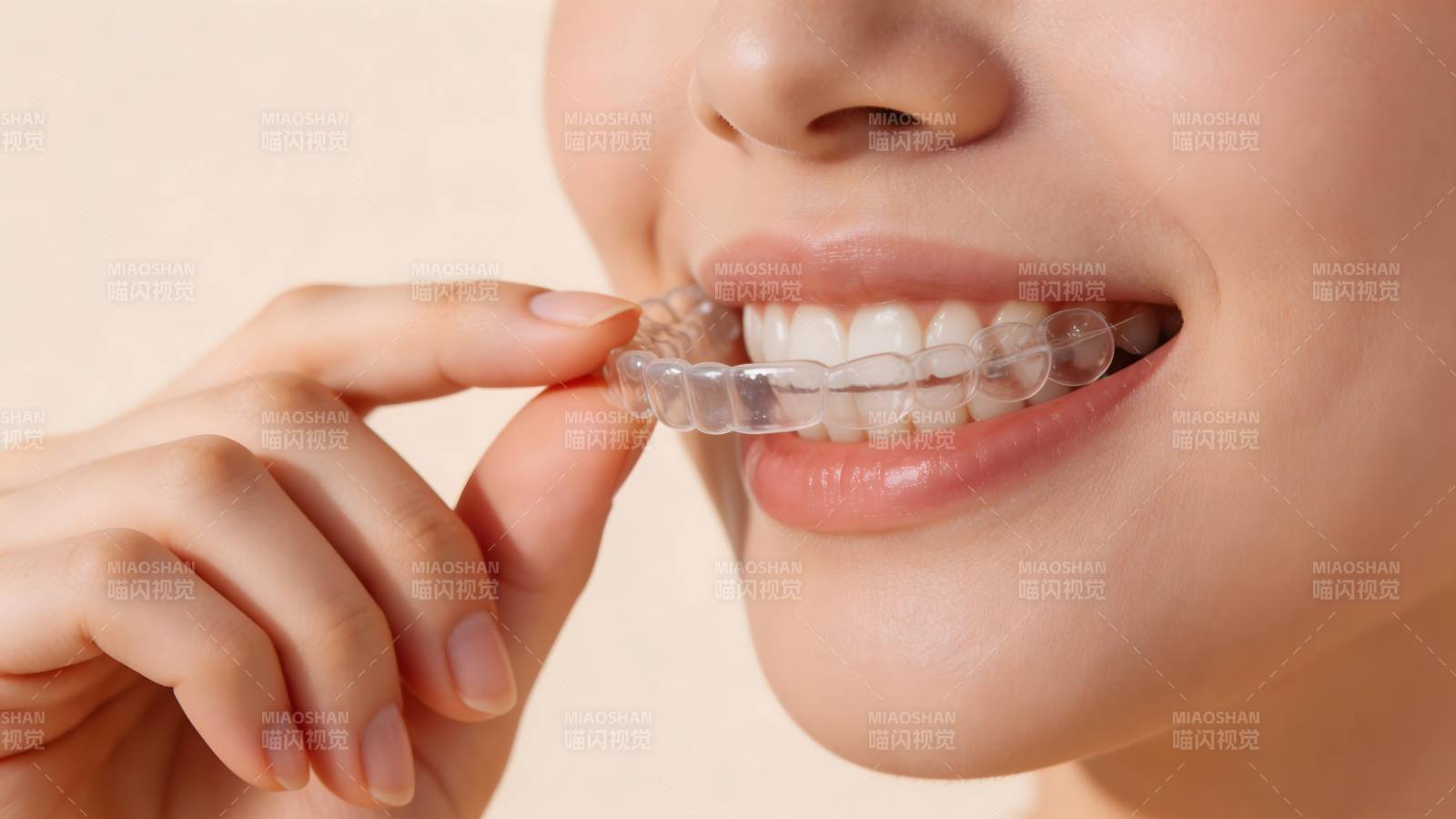 隐形牙套微笑美齿图片