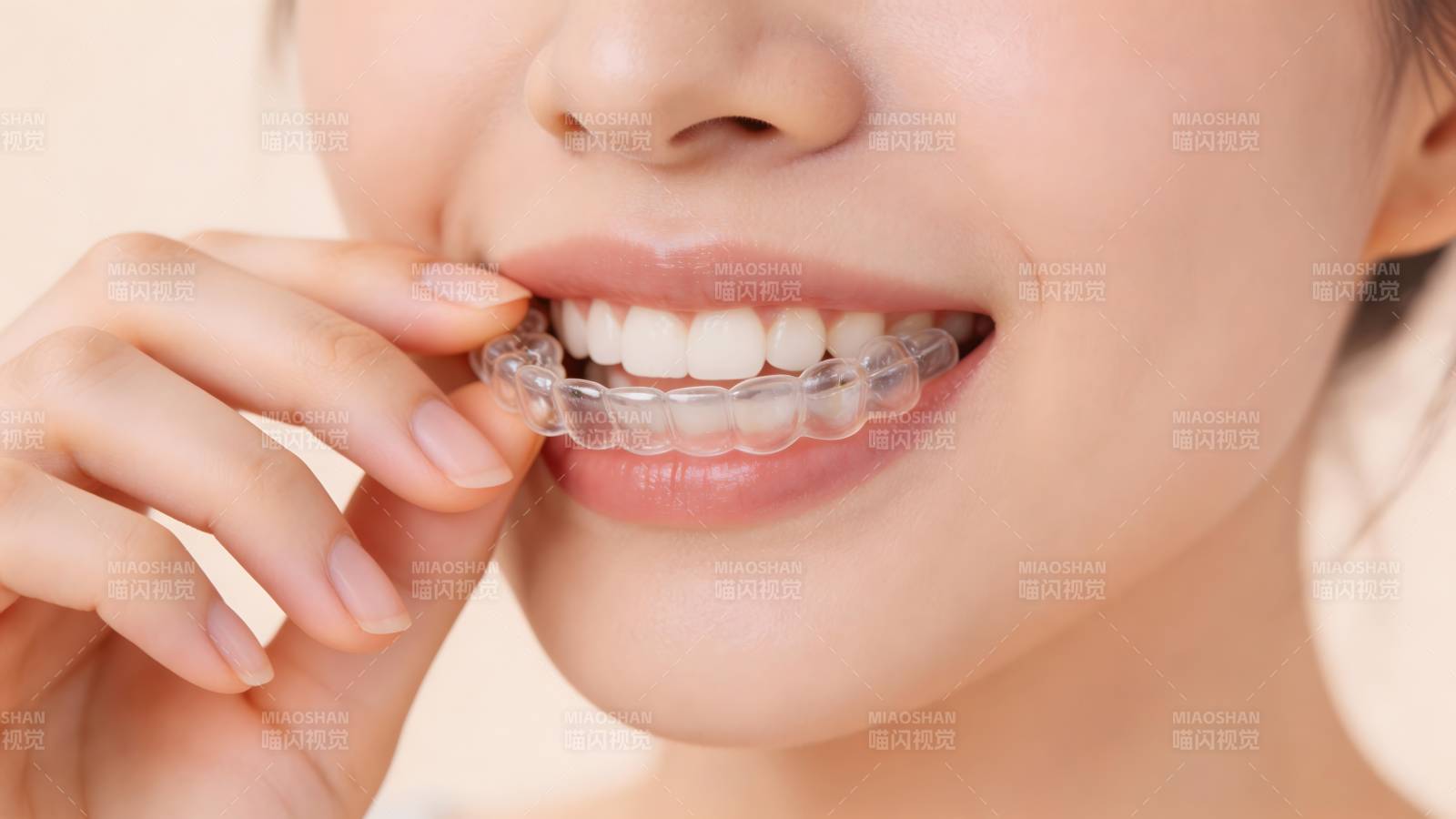 隐形牙套微笑美齿图片