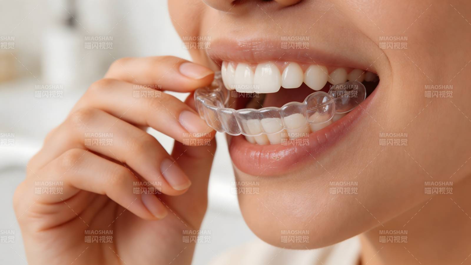 隐形牙套微笑美齿图片