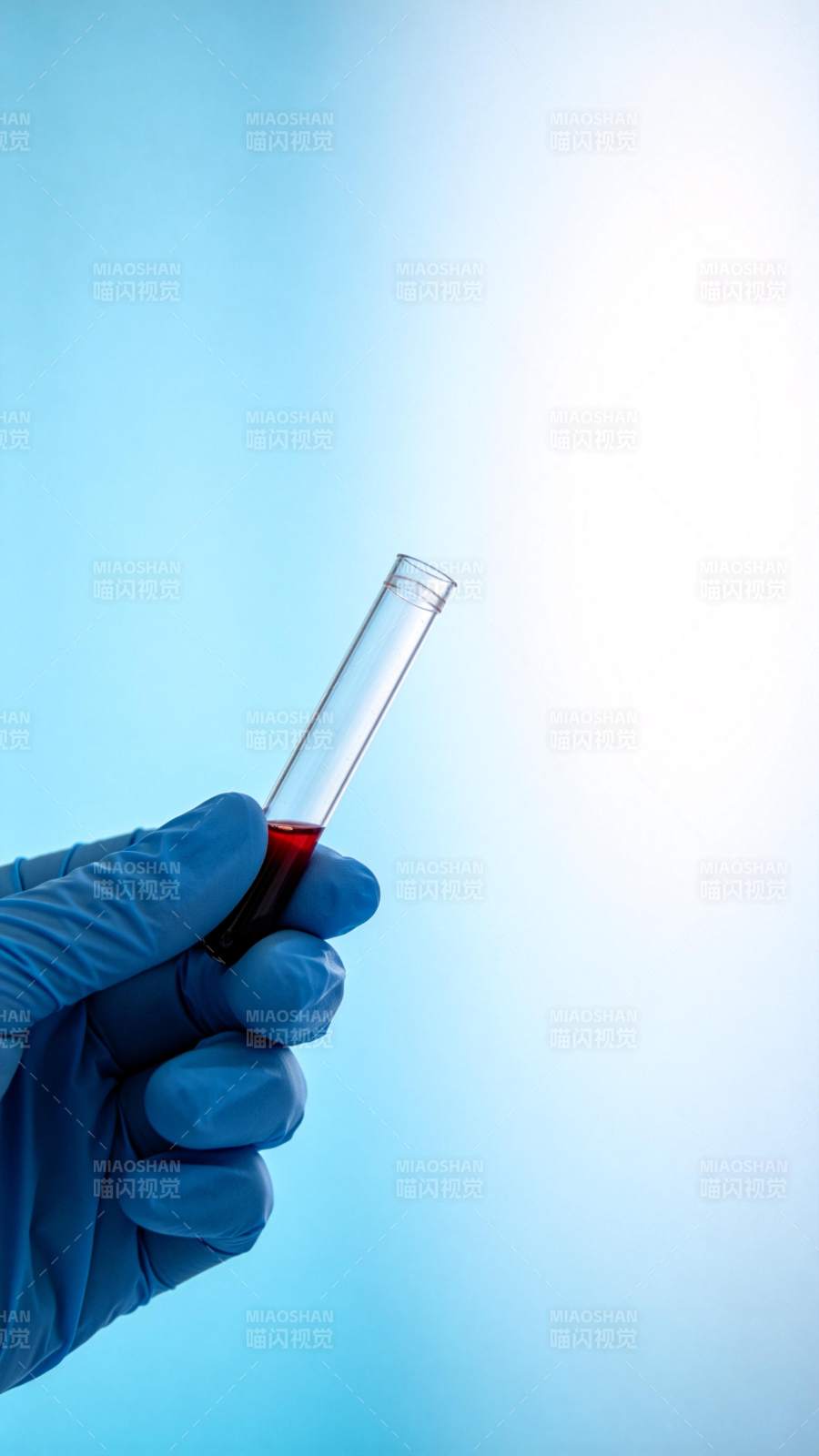 实验中的血样检测图片