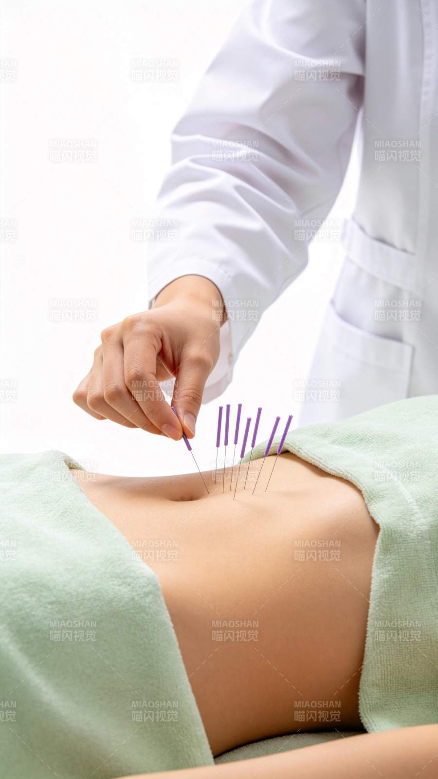 医生为患者腹部进行针灸治疗操作图片