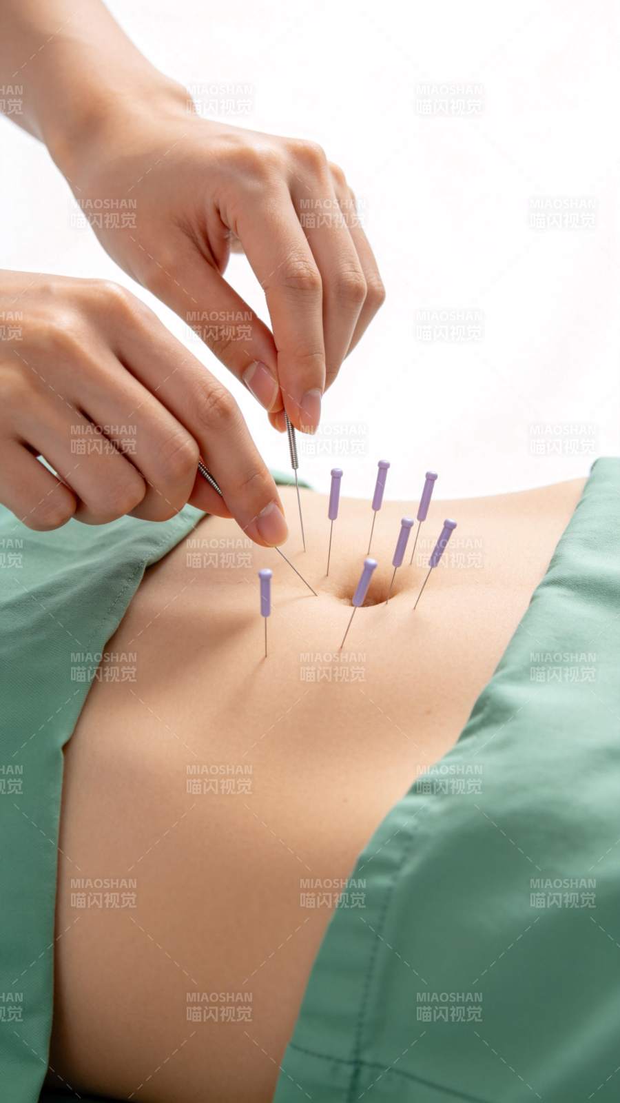 针灸治疗腹部穴位图片