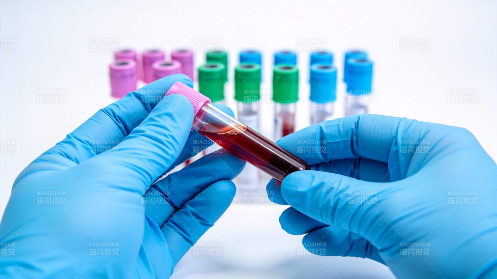 血液检测样本分析图片