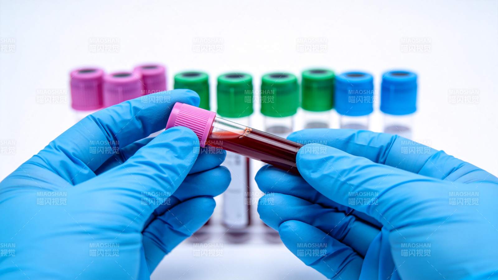 实验室血样检测图片