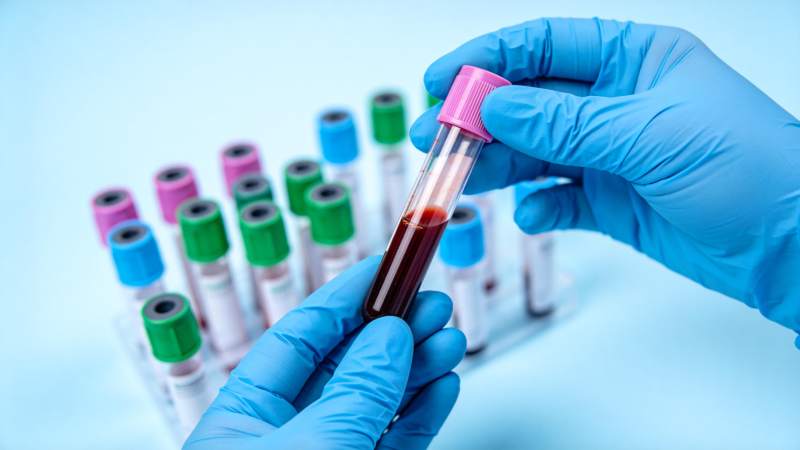 血样检测现场图片