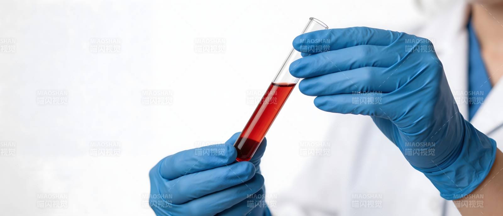 蓝手套持血样试管检测中图片