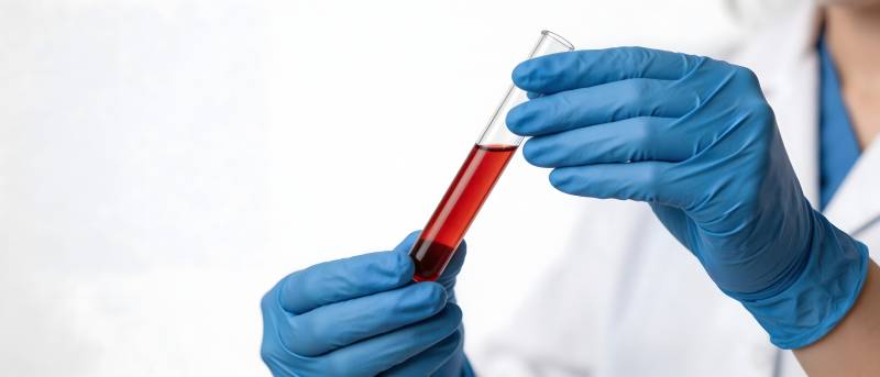 蓝手套持血样试管检测中图片