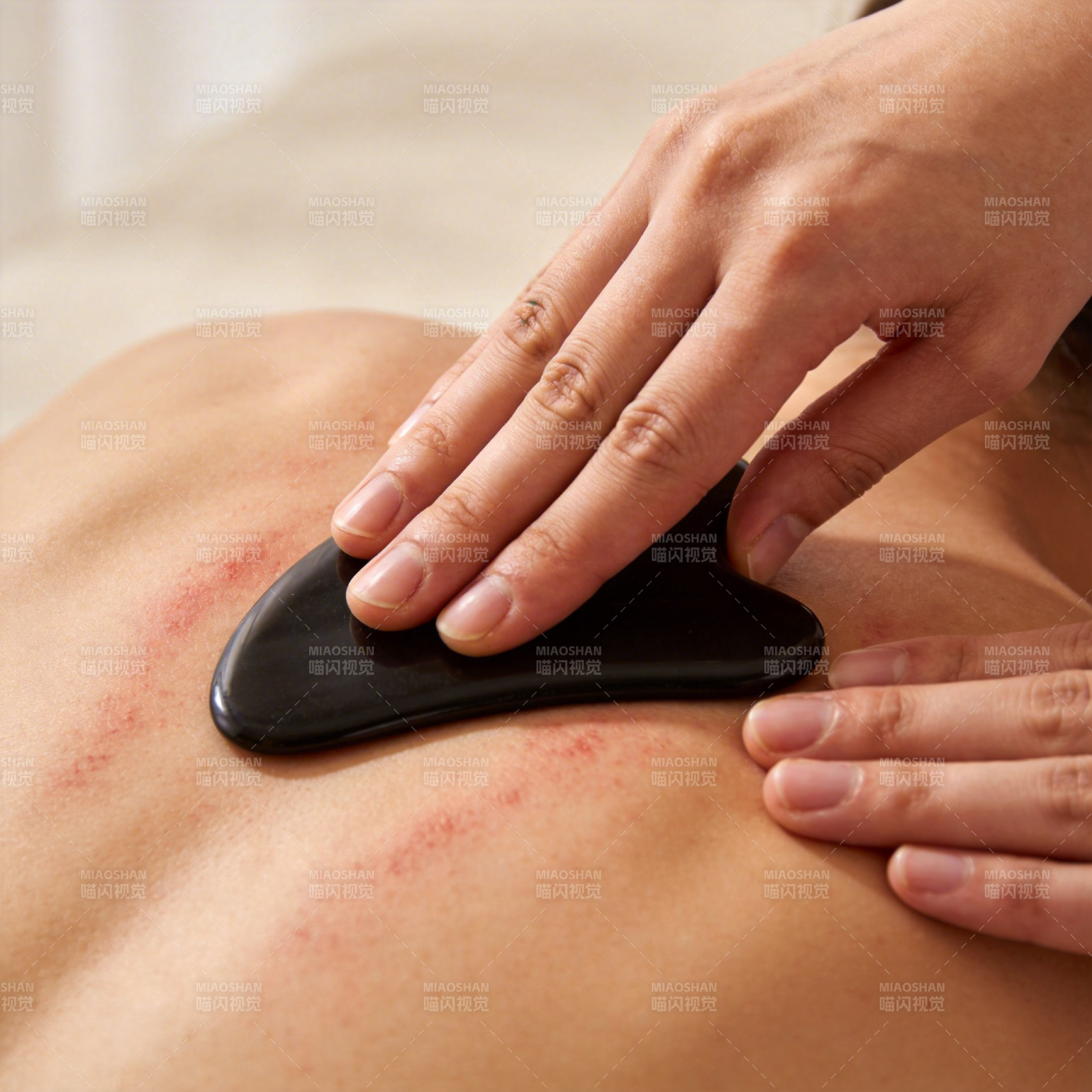 刮痧理疗 舒缓肩背图片