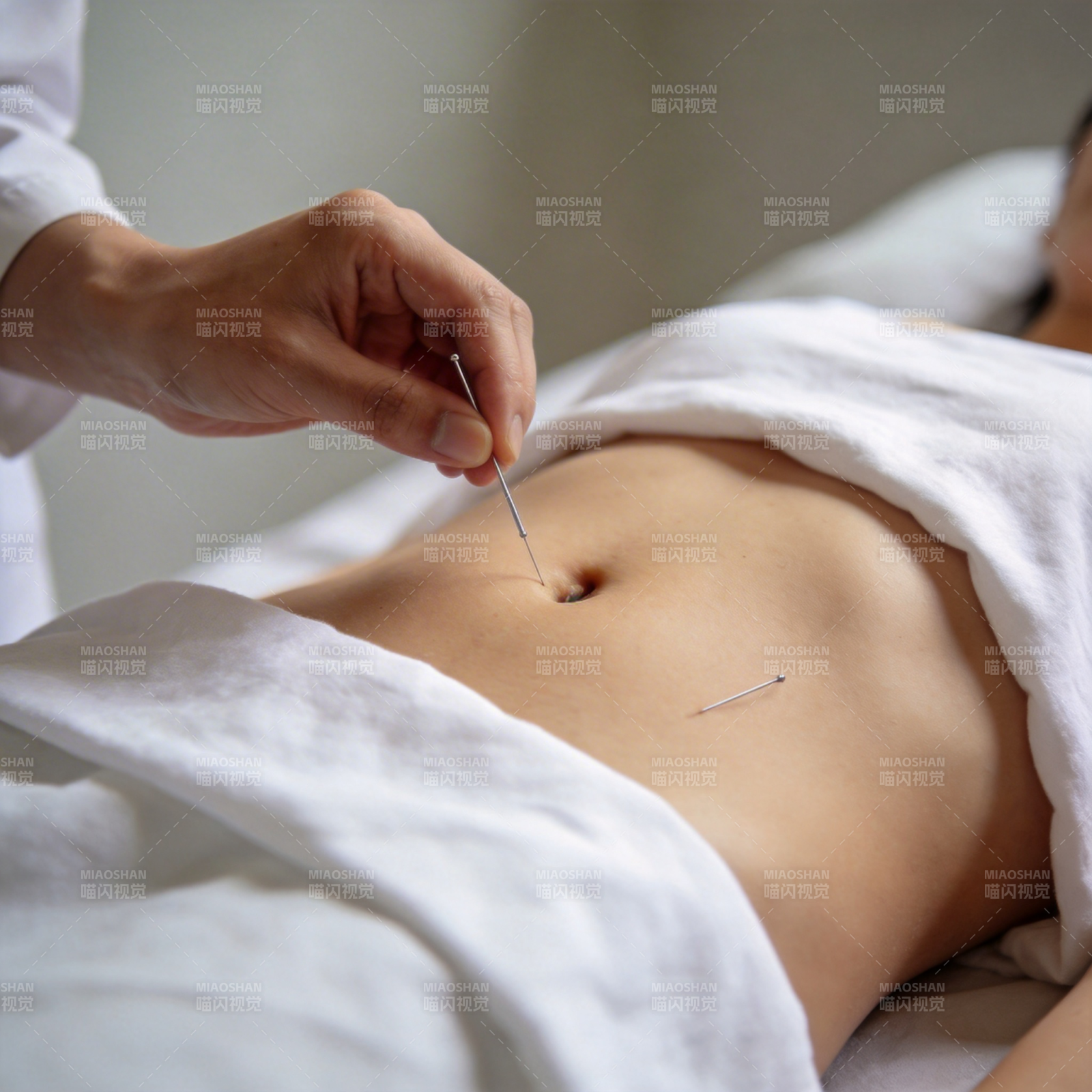 针灸治疗腹部穴位图片