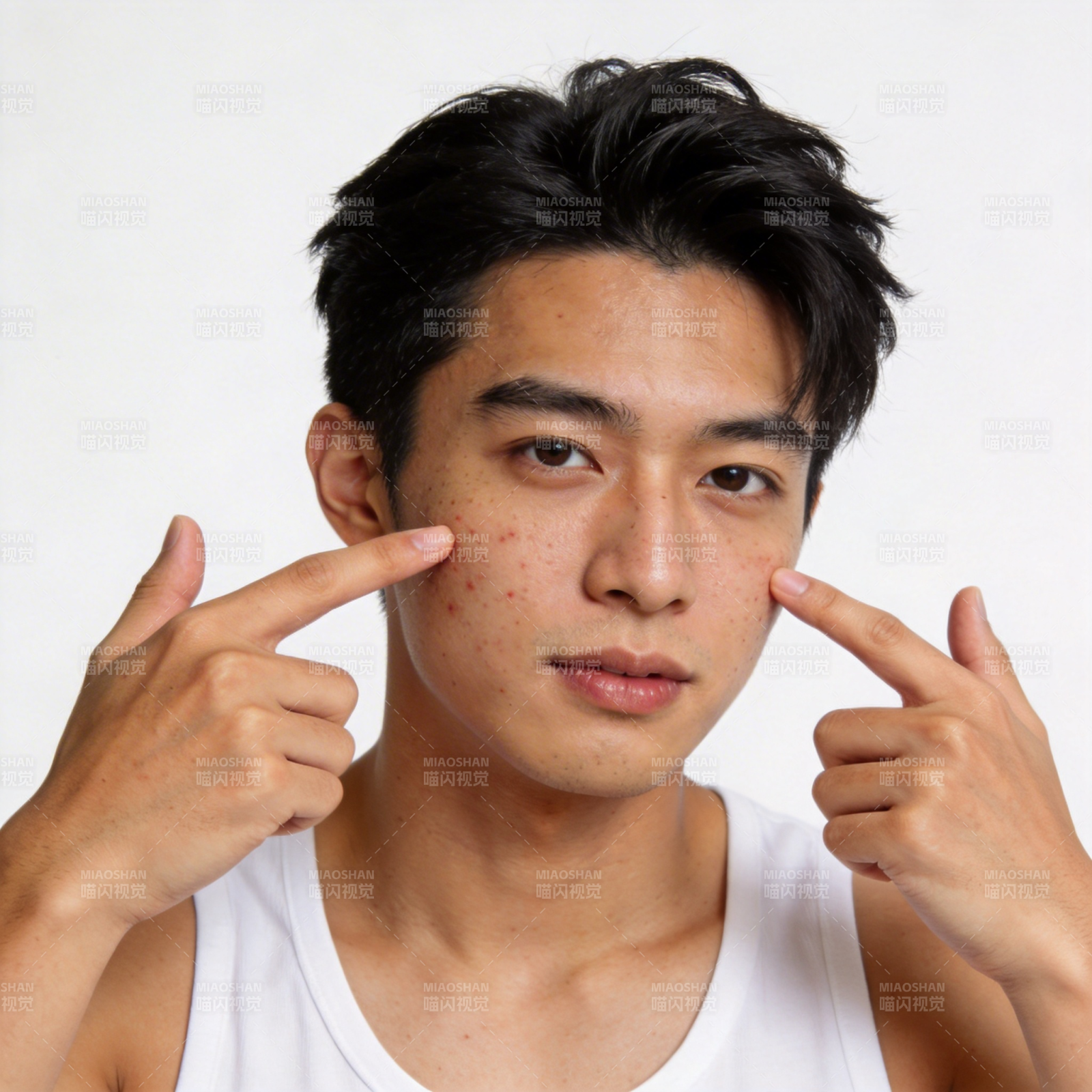 青年指脸示痘 关注肌肤问题图片
