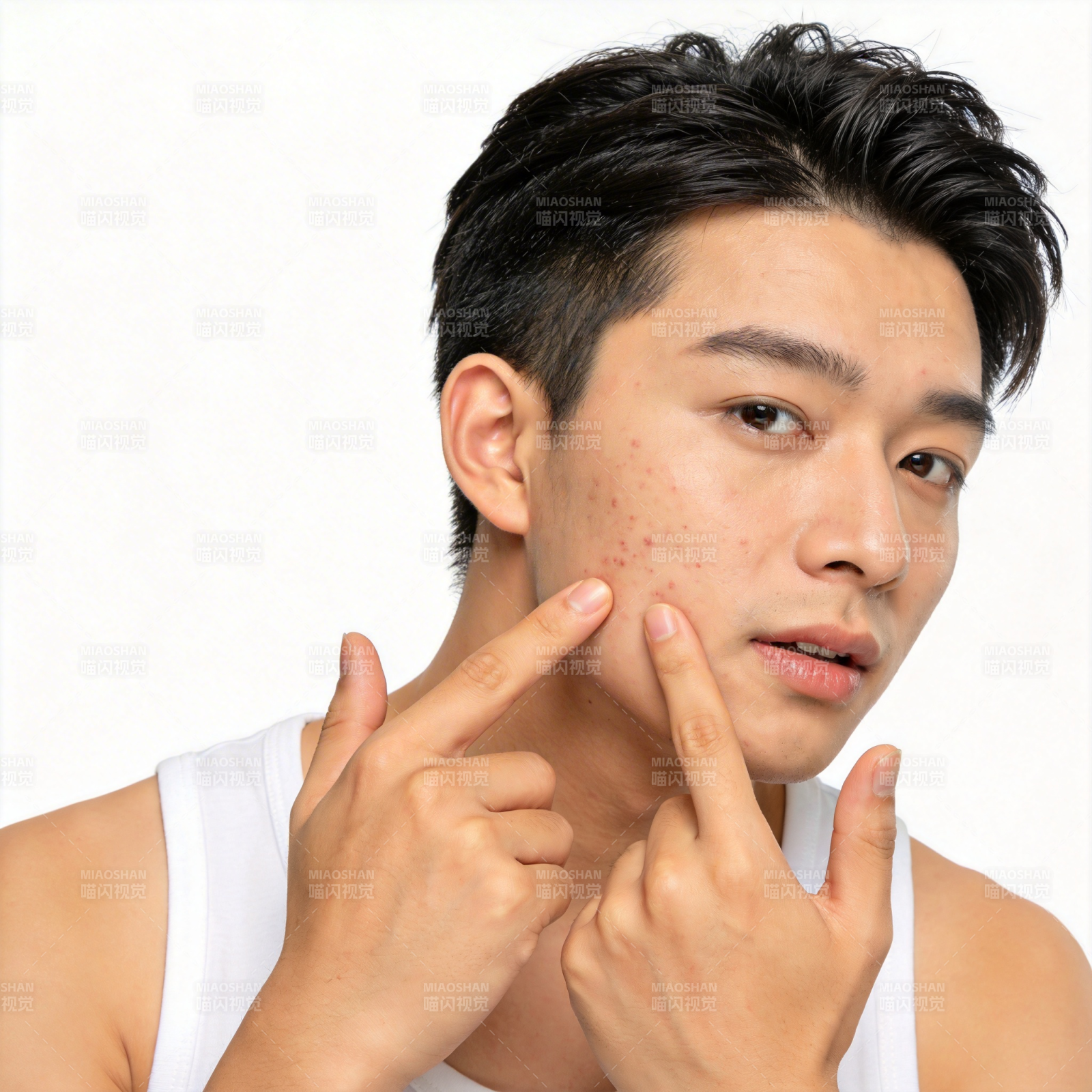 青年男子指脸颊痘痘图片