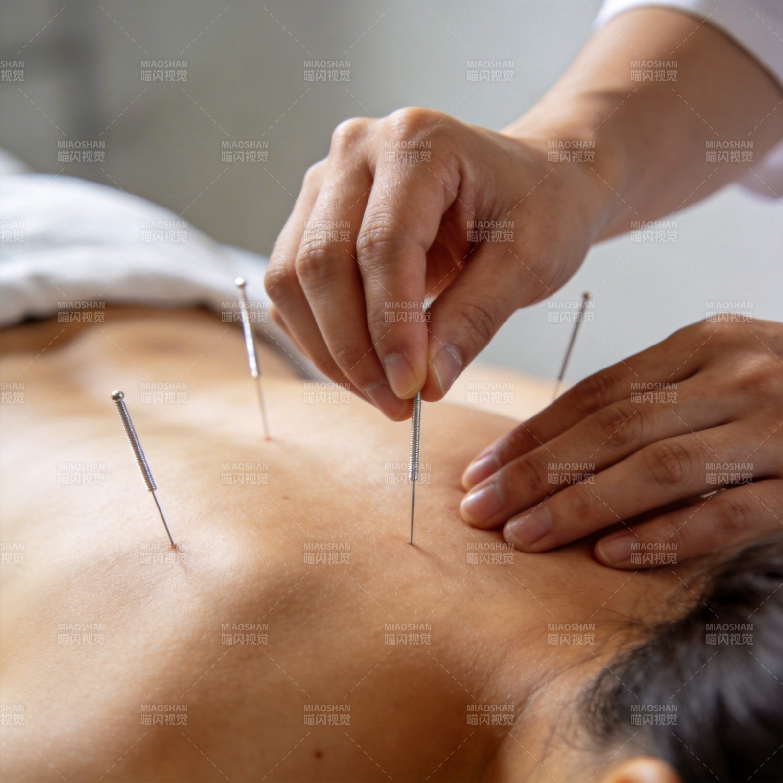 针灸治疗背部穴位图片