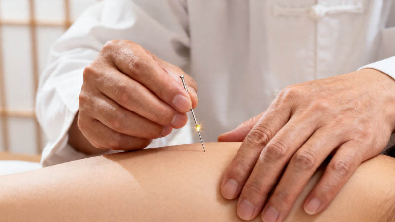 针灸治疗 精准施针图片