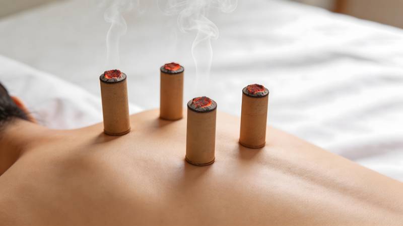 背部艾灸疗法 四柱冒烟温养图片