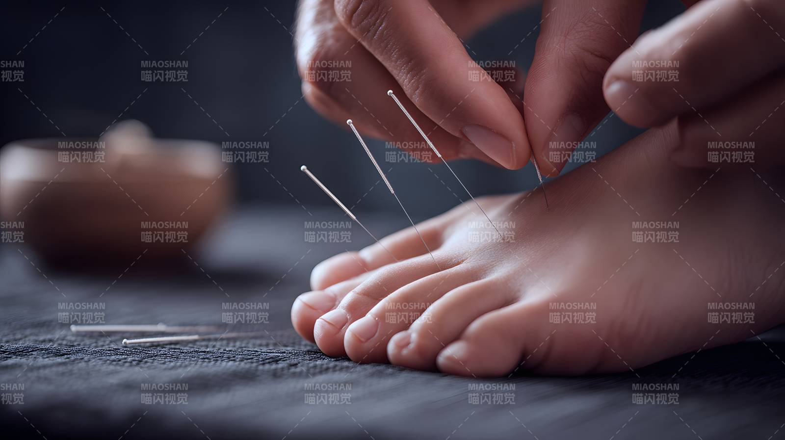 足部针灸治疗特写图片