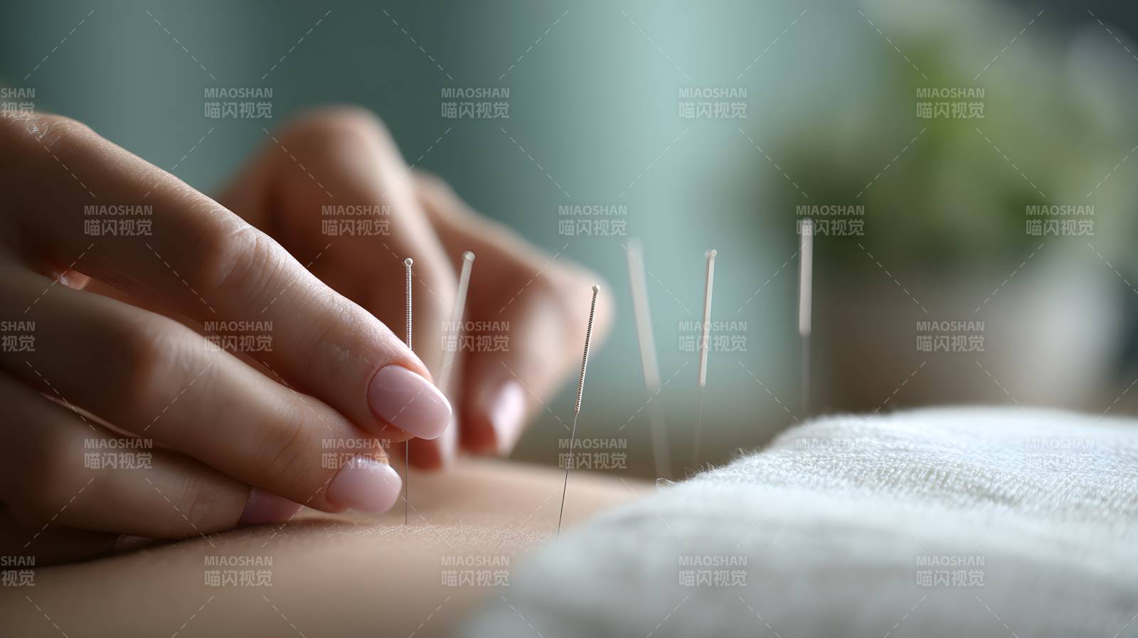 针灸治疗 细针入肤疗愈身图片