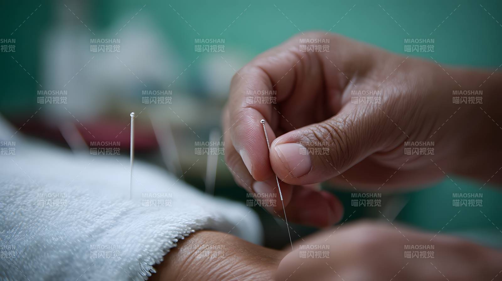 针灸治疗中 手正插针图片